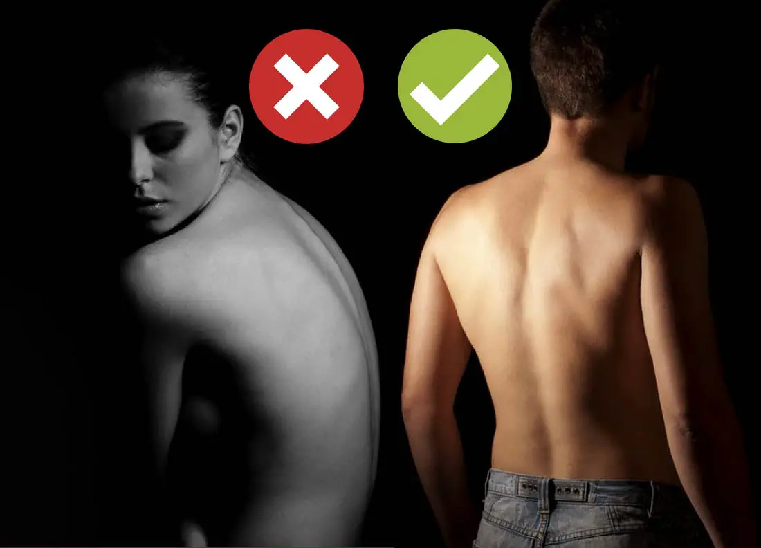 Correcting a scoliosis spine: 20 best exercises for an upright posture